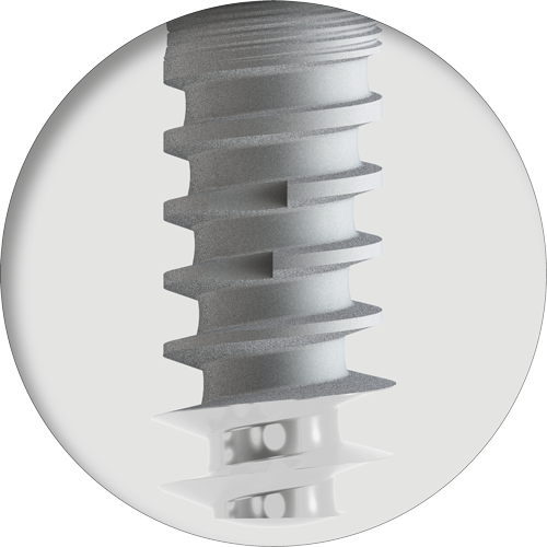 GIH2 Compression and Aggressive Apical Thread